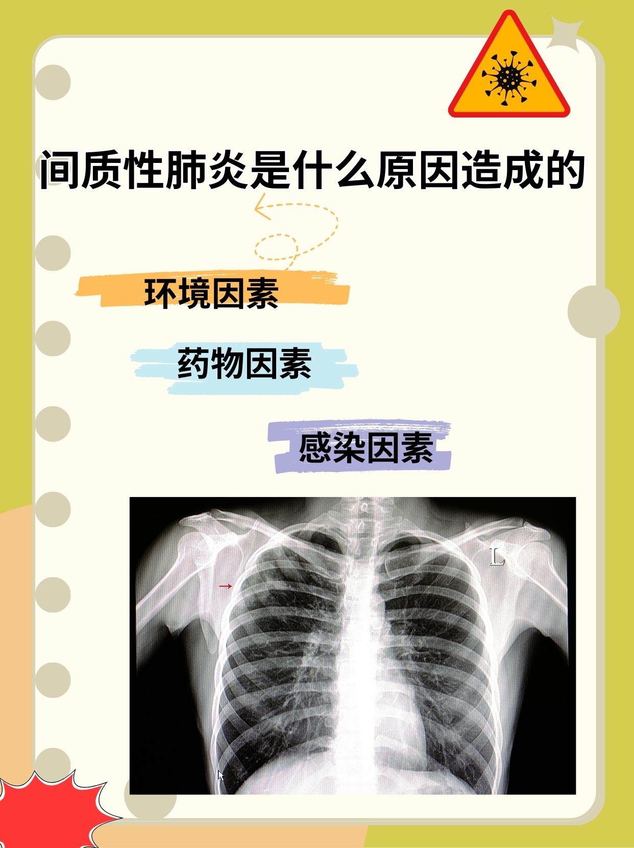 “2019年新型肺炎爆发” 2019新型肺炎叫什么名字？-第2张图片