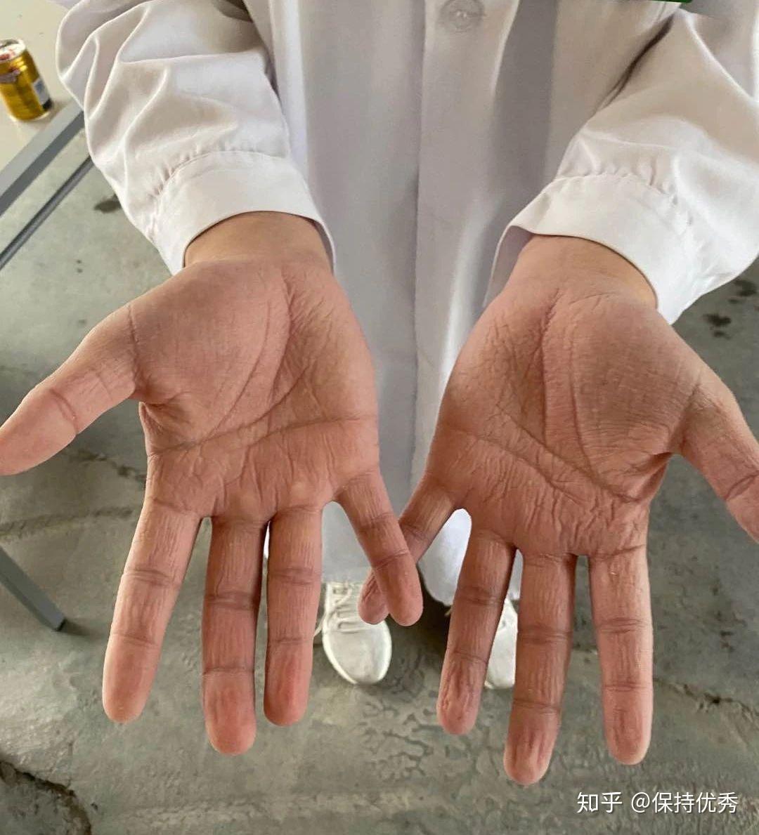 31省新增本土89例,31省新增本土61例i-第2张图片
